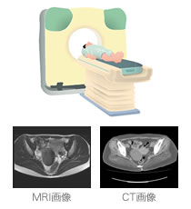 MRI画像　CT画像